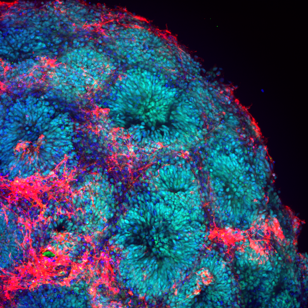 Life in tube: World of Stem Cell Research