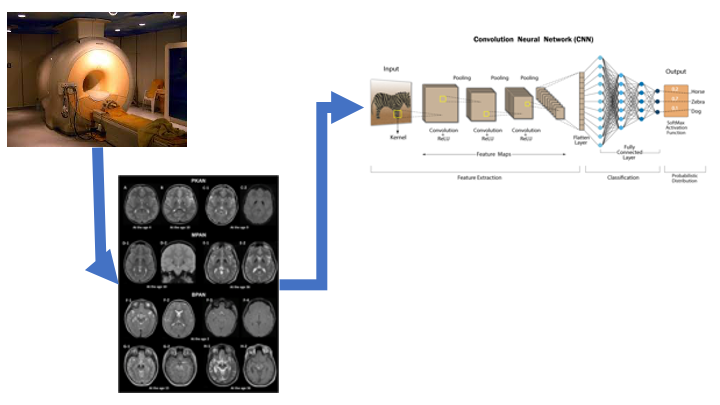Hogyan gondolkodik a mesterséges intelligencia az MRI felvételekről